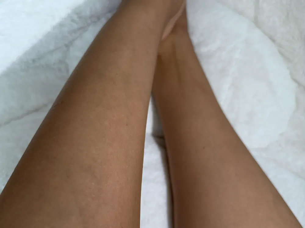Jambes lisses après plusieurs séances de laser